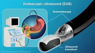 Understanding EUSFNA [upl. by Slyke]