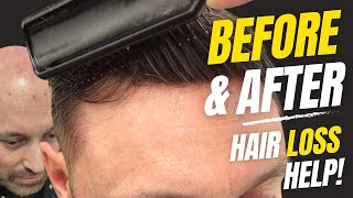 Before amp After  Hair System  Hair Loss To Full Hair In Minutes  Hair Replacement System Men UK [upl. by Dnumde308]