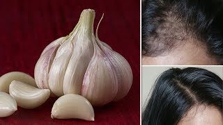 முடி வளர்ச்சிக்கு Garlic Hair Oil பூண்டு தைலம் செய்யவது எப்படி Homemade Garlic Hair Oil Making [upl. by Aeduj421]