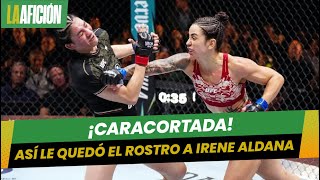 Irene Aldana sufre brutal corte en el rostro en su derrota ante a Norma Dumont [upl. by Ehlke]