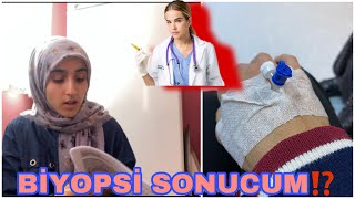 ENDOSKOPİKOLONOSKOBİ OLDUM❗️NASIL GEÇTİSONUÇLARIM NASIL [upl. by Rivera752]