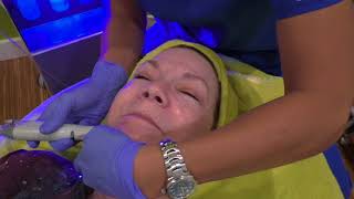 Hydrafacial Infusion with Peptides [upl. by Shirberg817]