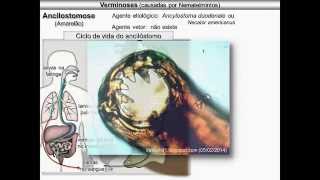 Verminoses causadas por nematelmintos [upl. by Orfield]