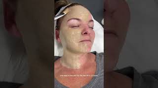 Do you have Melasma Hyperpigmentation or Freckles  Dr Medispa [upl. by Cigam747]