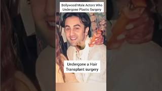 Bollywood Male Actors Who Undergone Plastic Surgery😳😍shortsranbirkapoor shahidkapoorsalmantiger [upl. by Dowdell]