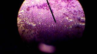 STAPHYLOCOCCUS EPIDERMIDISGRAM STAINED [upl. by Jezrdna]