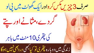 Gurde Masane ki Pathri ka ilaj  Kidney Stones Bladder Pain [upl. by Marquet]