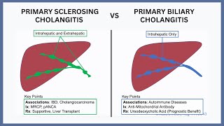 Primary Biliary Cholangitis vs Primary Sclerosing Cholangitis [upl. by Notsgnal563]