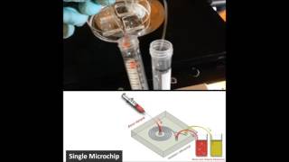 Multiplexing slanted spiral microchannels for ultrafast blood plasma separation [upl. by Enelra984]