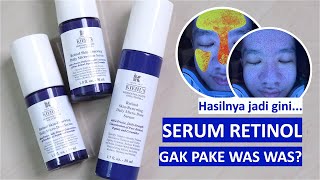 Kupas tuntas Kiehls Retinol Skin Renewing Daily Micro Dose Serum Anti aging gentle terbaik… [upl. by Trebreh]