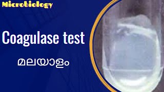 Coagulase test  malayalam [upl. by Ahsirahc]