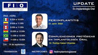 UPDATE en Implantología Oral [upl. by Salokin]