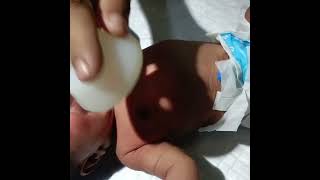 Chestryped being newborn baby yputubeshorts shakeelnursingwork shorts video virals gnm [upl. by Ardekal]