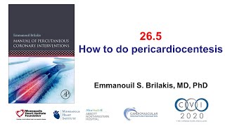 265 Manual of PCI  Pericardiocentesis [upl. by Sivrahc]