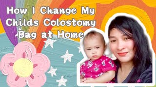 How To Change Colostomy Bag  Paano Mag Palit Ng Colostomy Bag [upl. by Nielsen]