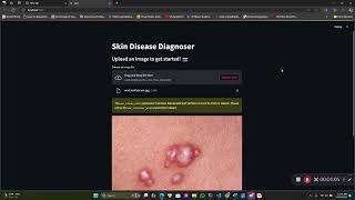 Skin Diseases Diagnoses AI [upl. by Nitaj372]