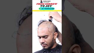 HAIR TRANSPLANT IN LOW COST SHORTS TANNUDADA HAIRTRANSPLANT [upl. by Nnyllaf]