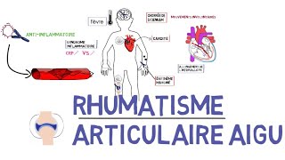 Rhumatisme articulaire aigu RAAde A à Z [upl. by Eidlog539]