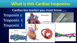 What is this Cardiac troponinsCardiac bio markers in Myocardial ischemia [upl. by Annehsat]