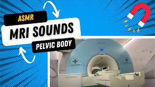 🎧🧲 ASMR Pelvic Body MRI Sounds Siemens Magnetom Avanto 15T Magnet [upl. by Jelle]