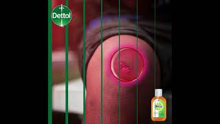 Dettol Antiseptic Liquid for wounds [upl. by Rey]