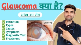 Glaucoma in Hindi  Causes Types Symptoms and Treatment of Glaucoma [upl. by Enohpesrep]