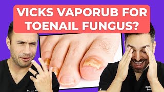 Ointment To CURE Toenail Fungus  Doctorly Investigates [upl. by Gifford]