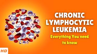 Chronic Lymphocytic Leukemia – Causes Signs and Symptoms Diagnosis amp Treatment [upl. by Nyleaj]