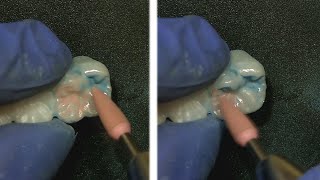 Achieve an incredible polish on Zirconia Dr Jason Smithson [upl. by Poll691]