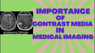 Importance of contrast media in Medical imaging  Radiotherapy edutech [upl. by Ahsimet]