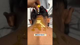 💯Dark Neck Cleaning TipsDead Skin remove instantly Remove Suntan Easily ytshorts skincare diy [upl. by Hogg]