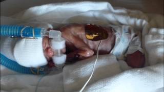 Our 27 week old preemie 115 lb miracle  Kaitlyns First Year [upl. by Violetta711]