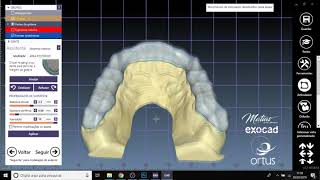 Placa miorrelaxante  Articulador Virtual  Alexandre Matias Dental Designer  Exocad [upl. by Millur556]