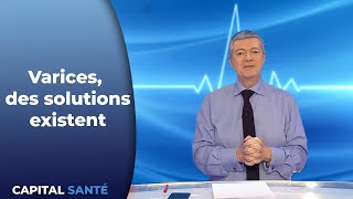 Varices des solutions existent [upl. by Aiclef]