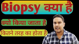 what is biopsy  Biopsy test  Biopsy test in hindi [upl. by Melisa]