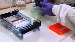 How to run an agarose gel [upl. by Maker]