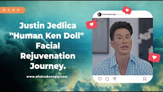 Justin Jedlica quotHuman Ken Dollquot Facial Rejuvenation Journey [upl. by Nivanod]