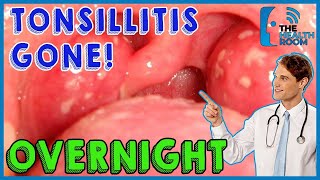 10 Effective Tonsillitis Home Remedies That Work Fast [upl. by Leno746]