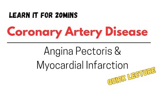 Atherosclerosis Angina Pectoris and Myocardial Infarction lecture discussion [upl. by Kirtley137]