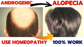 Homeopathy Medicine For Androgenic Alopecia  Homeopathy Medicine For Hair Fall And Regrowth [upl. by Manlove]