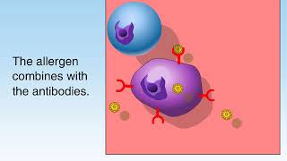 How Allergies Work Animation Understanding Allergic Reaction Immune System Video Symptom Treatment [upl. by Guevara]