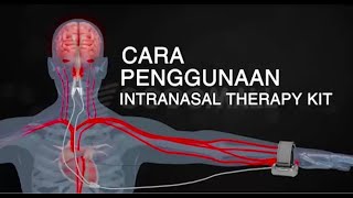 Cara Penggunaan Intranasal Therapy Kit [upl. by Nickolaus]