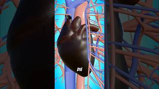 How Heart Attack Is Caused [upl. by Euphemie]