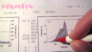 chernobyl 2012 albedo personal dosimeter dose report vs brazil holiday radiation [upl. by Sara]