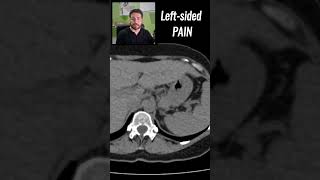 Is this PAINFUL Spot the disease  CT SCANS Ep 16 medicalimaging abdominalpain medicalquiz [upl. by Ume]