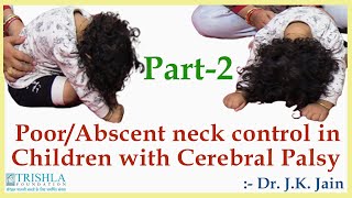 Poor Neck control in Children with Cerebral Palsy treatment amp therapy at Trishla Foundation [upl. by Sucul]