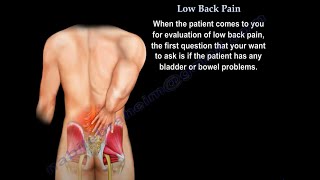 Low Back pain causes diagnosis imaging and treatment [upl. by Aelyk]