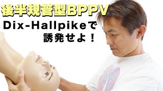 後半規管型BPPV誘発術（DixHallpike test：BPPVの診察（Part3） [upl. by Lottie129]