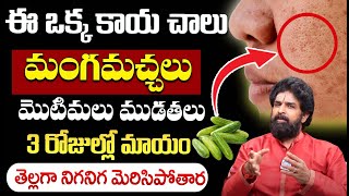 Pigmentation Treatment At Home Home Remedies For Pigmentation  Remove Pigmentation  Vikram Aditya [upl. by Licna855]