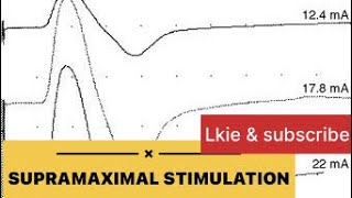 What is Supramaximal stimulation in NCS [upl. by Libby224]